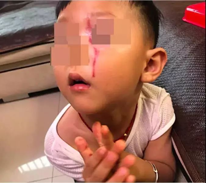 涓婃捣濂冲瓙琚儓鎬х姮鍜激鍚庣画,娌笂骞磋交濂冲瓙琚埍鐘挰鑷村攪鎾曡