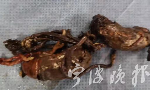 都在夏天发病！宁波夫妇相继呕吐全身抖动！只因喝了这种汤