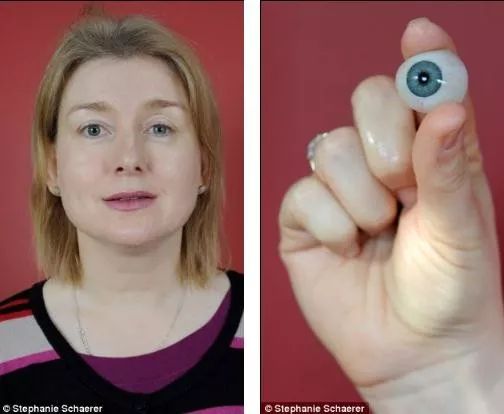 戴隐形眼镜眼睛长虫有什么症状,戴隐形眼镜把眼角膜磨坏了