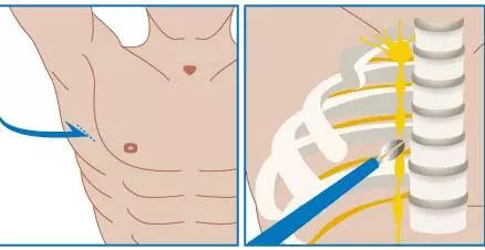 手汗多看什么科,治手汗看什么科