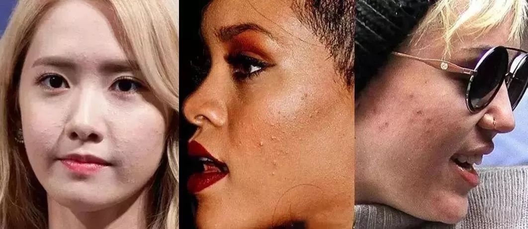 脸上搓出3斤泥！难怪又黄又暗又黑头！10秒给脸蛋“剥壳”，厉害