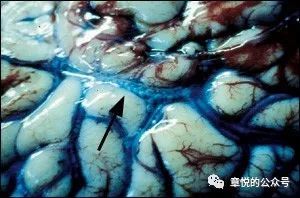 常见潜水疾病,潜水多深才会得潜水病