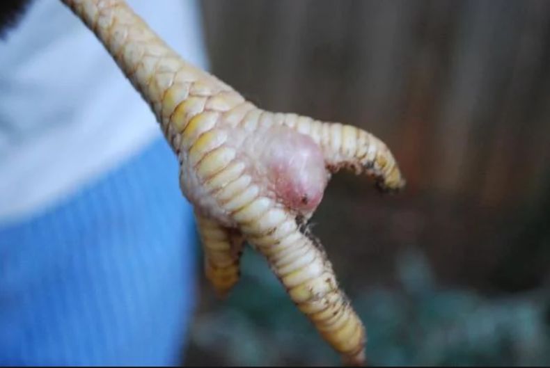 金色葡萄球菌感染会死吗,金色葡萄球菌感染有危险吗