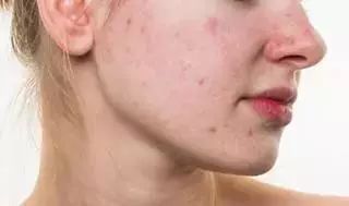 祛湿足贴的效果好吗,韩版养生祛湿足贴