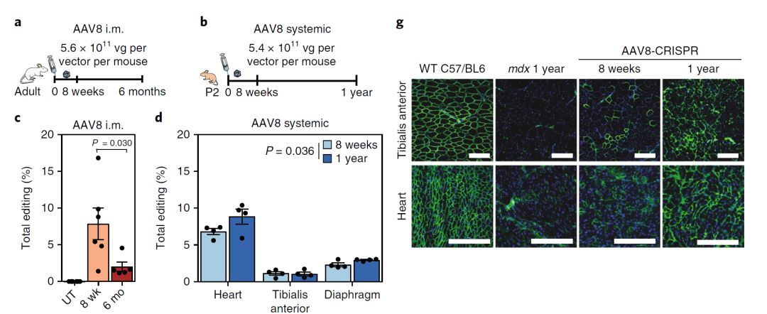 杜氏肌营养不良基因疗法最新进展,进行性肌肉营养不良基因检测