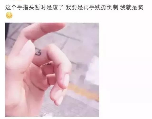 一个没注意，手指倒刺变截指！这个动作千万别再做了！