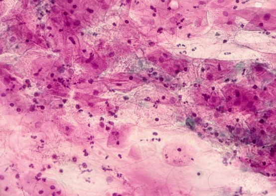 意大利女生撩人秘诀！每天1滴斩男香，能提升你70%销魂度