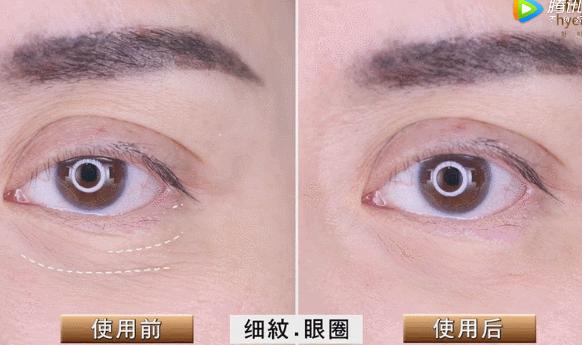 解决皱纹色斑粗糙干燥就用这一套,淡化各种皱纹特别快的好方法