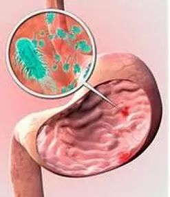 脾胃不好口臭怎么治最有效的方法,脾胃引起的口臭怎么快速解决