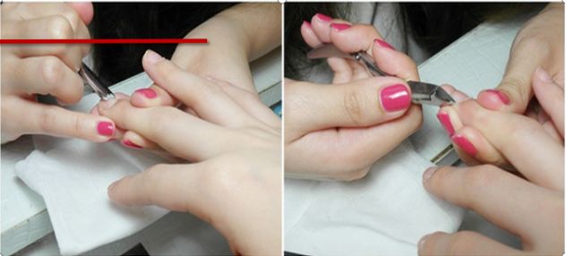 灰指甲致癌吗,灰指甲美甲的禁忌