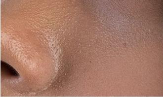 脸上搓出3斤泥！难怪又黄又暗又黑头！10秒给脸蛋“剥壳”，厉害