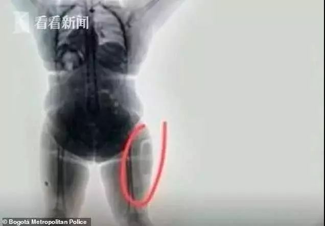 真把自己当“*皮人**袋”用，女子为藏毒竟将*品毒**缝在……