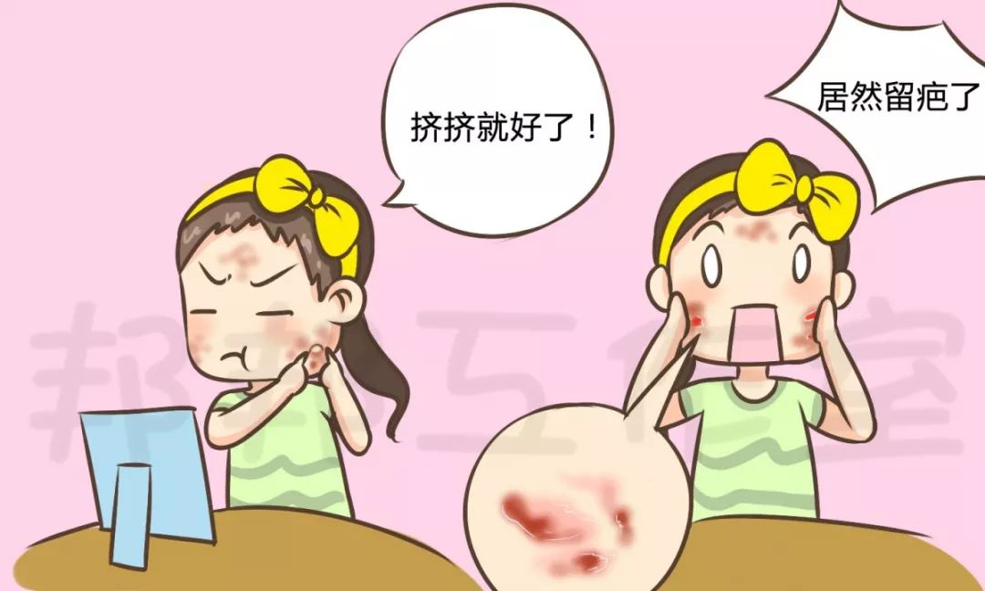 痘痘一直不好怎么办,女生脸上痘痘一直不好