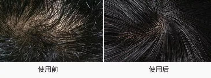 真正好用的洗发神器,一款超级好用的洗头神器