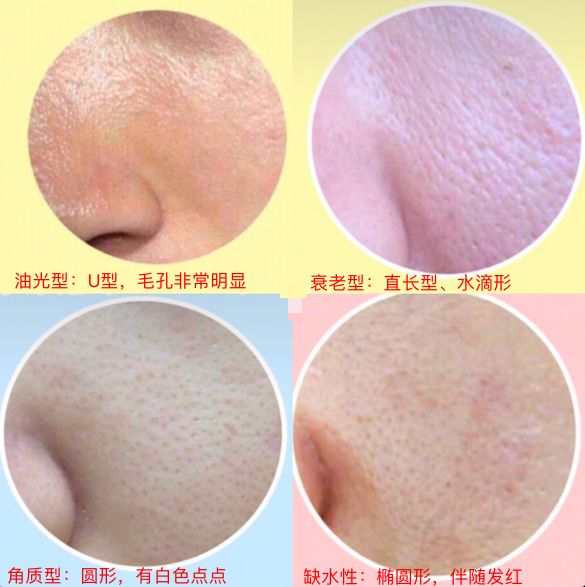 鍗佸勾铚曞彉缁堟垚鐢风,鍗佸勾铚曞彉tfboys