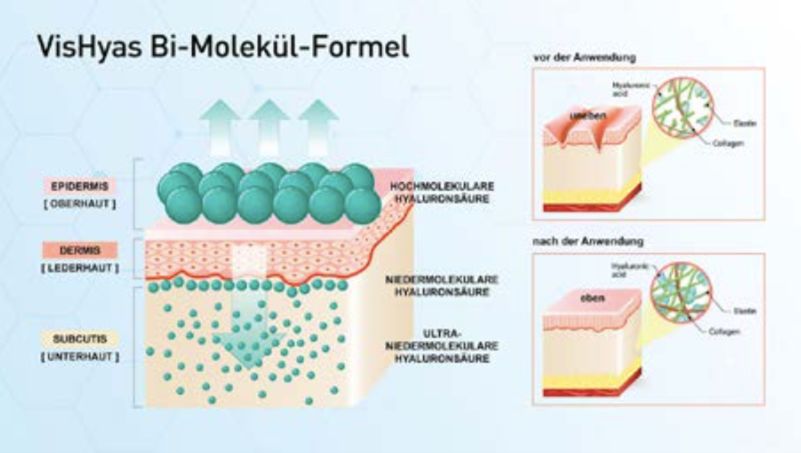 vishya玻尿酸德国价格,德国balea玻尿酸原液使用方法
