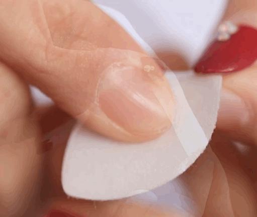 法令纹又黑又长,法令纹又深又长好吗