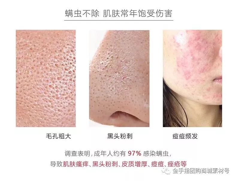 金手指团购72包,金手指抖音团购票