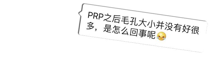 关于医美的真相大全,两年医美的真实感受