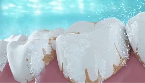 牙龈上火牙周护理牙膏,牙龈上火牙膏