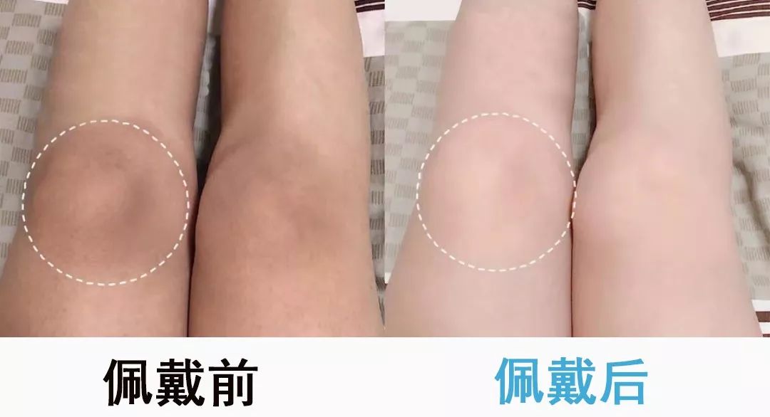 冬季保暖护膝告别老寒腿,保暖护膝零下10度