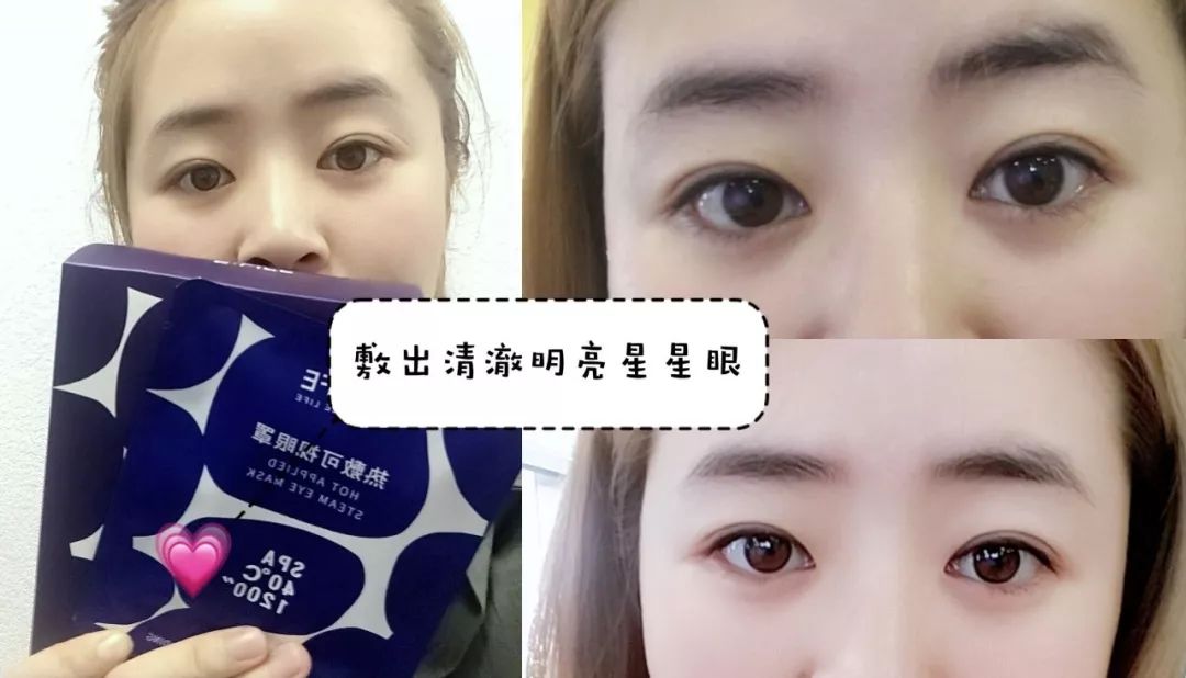 适合熬夜的护眼神器,眼睛疲劳用什么护眼神器