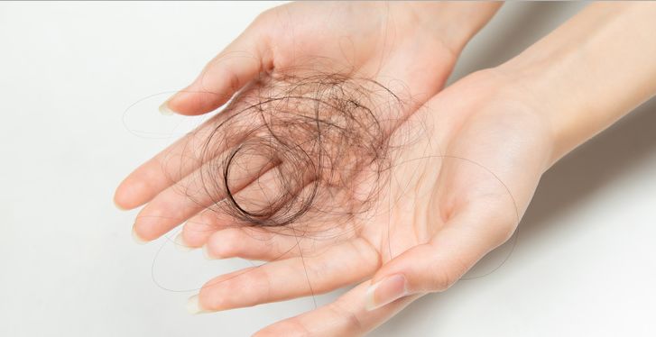 杭州95后小伙掉发严重,杭州95后小伙脱发