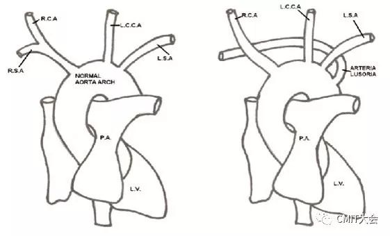 冠脉造影技术成熟不,跟我学技术分析从入门到精通