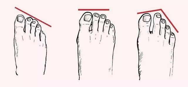 女人的真假鉴定,女性的脚怎么能看出是否健康