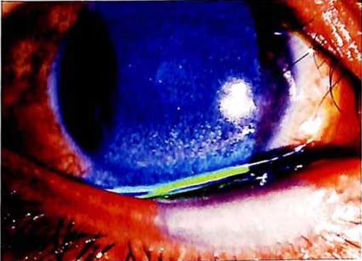 幼儿园教师疏忽导致安全事故,幼儿园疏忽管理导致孩子受伤