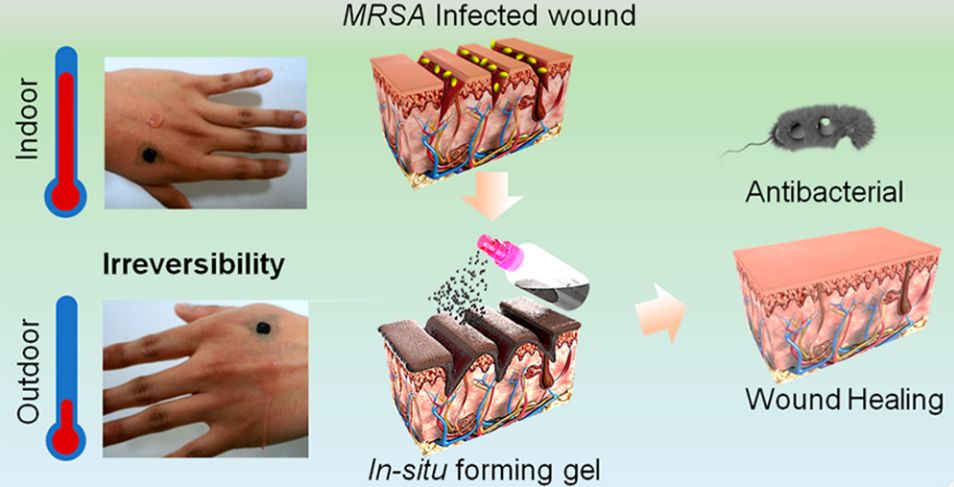 只需喷一喷？合肥工大学者研发出用于耐药性细菌感染伤口处理的可喷涂原位成型水凝胶