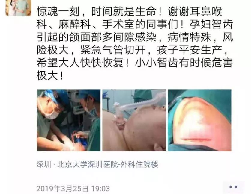 智齿到底该不该拔医生坦诚实情,智齿蛀了为什么牙医不建议我拔