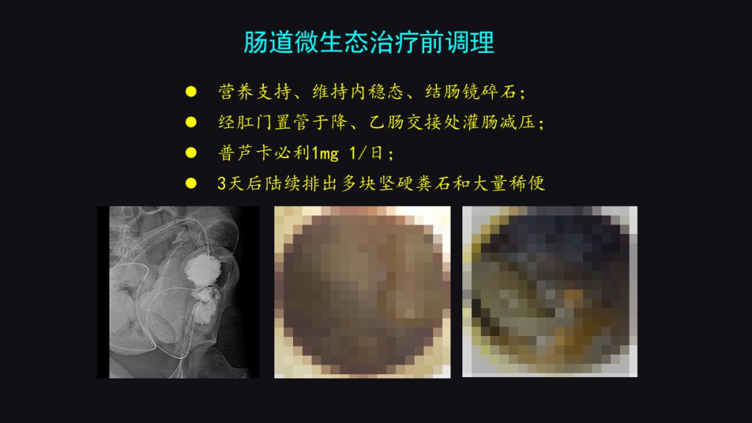 李宁奋斗历程英文版,李宁夜以继日