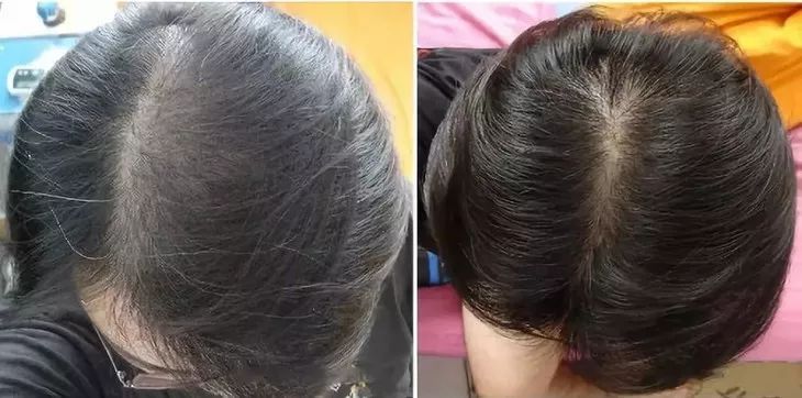 用它泡脚能赶走5种病,一个泡脚小药方赶走多种病