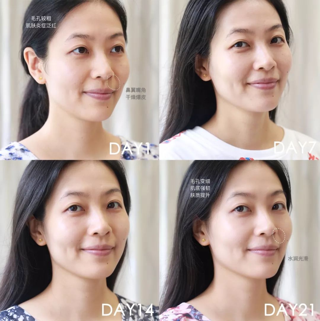 肌诊室·特别版|真人体验，医美素颜光vs明星微精华，改善皮肤哪家强？