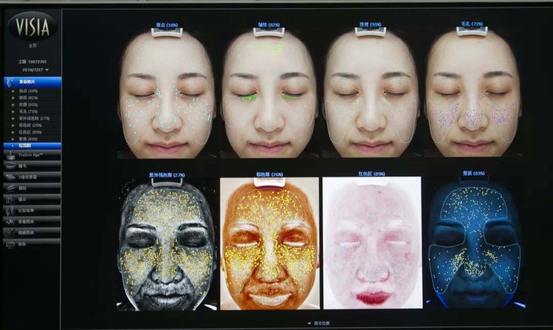 肌诊室修复,肌诊室水光肌挑战