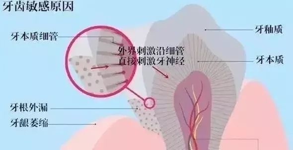 谢谢这支瑞士大牌牙膏，让我痛快吃火锅喝奶茶
