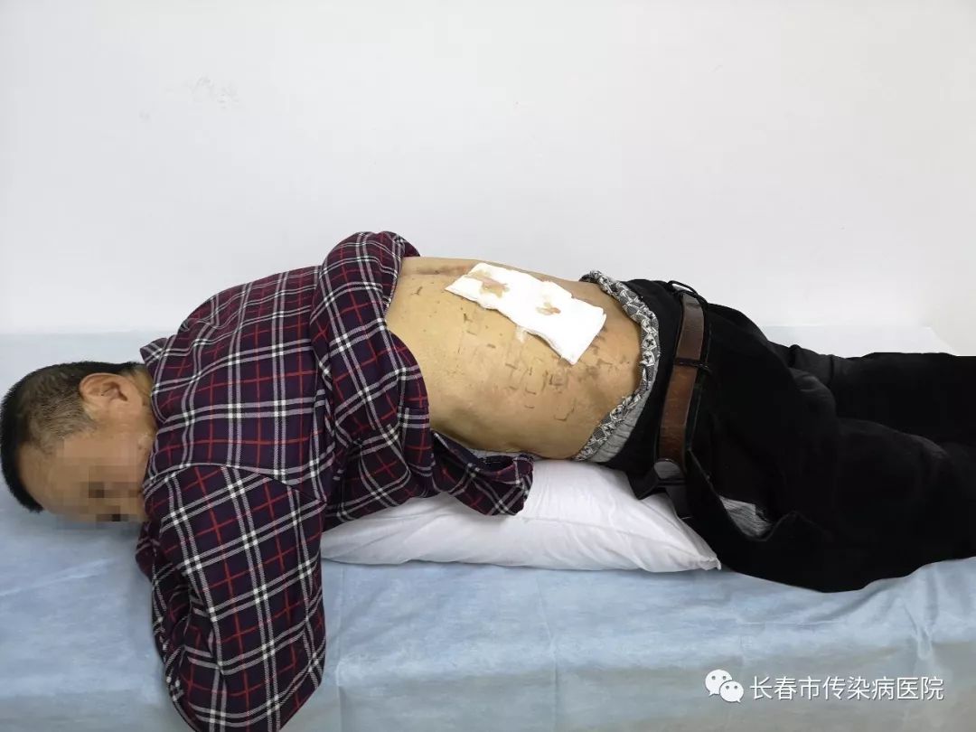 医患感人故事,医患和谐的暖心故事