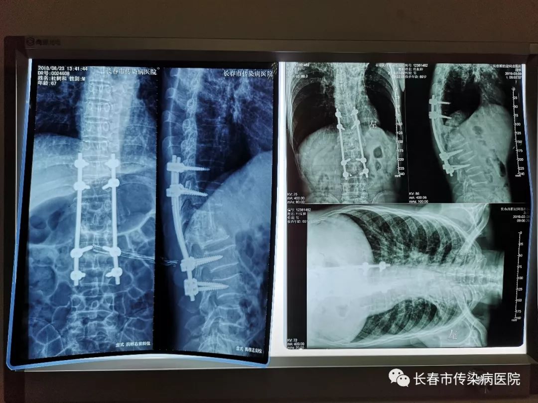 医患感人故事,医患和谐的暖心故事