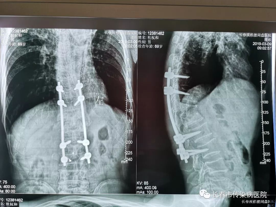 医患感人故事,医患和谐的暖心故事