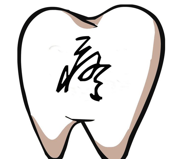 牙痛吃什么药最快见效,牙痛吃什么药见效快