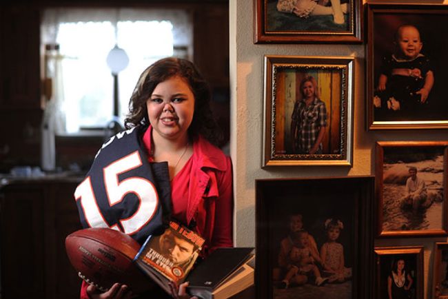 “老年痴呆“为啥叫阿尔茨海默病？告诉你10种以人名命名的疾病