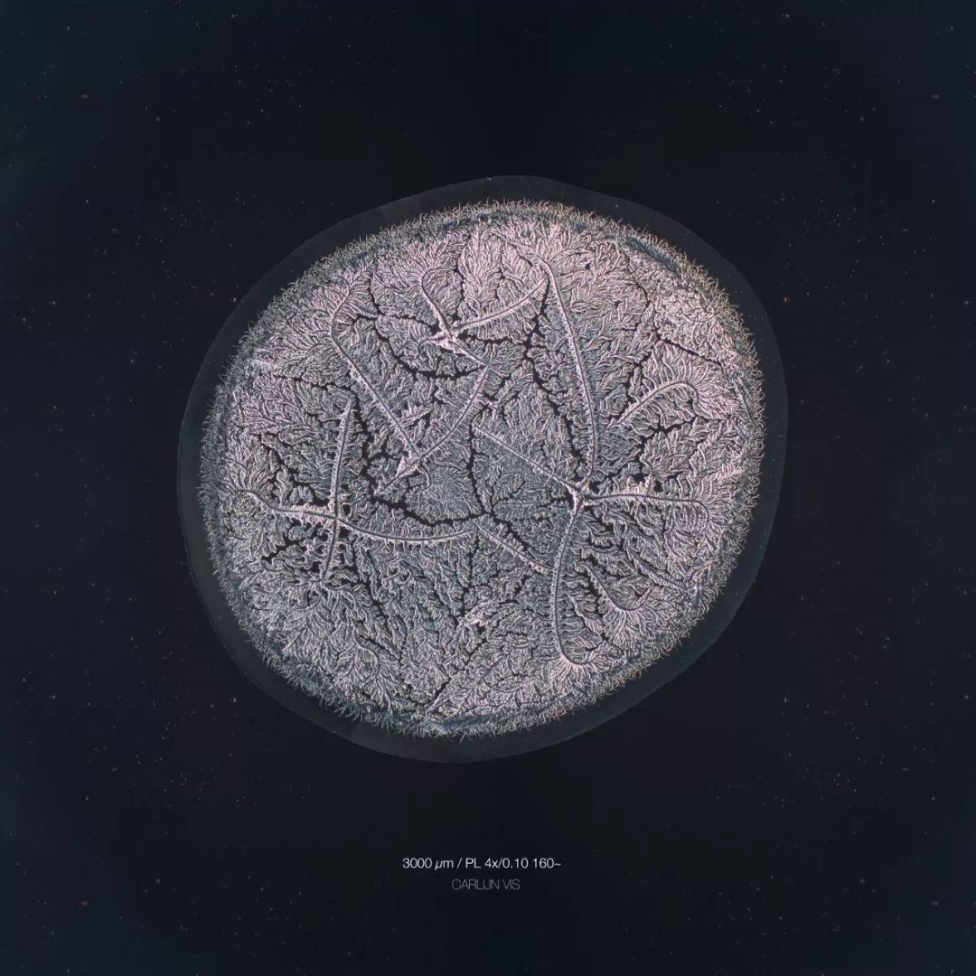 显微镜下的各种眼泪,显微镜下的眼泪原版