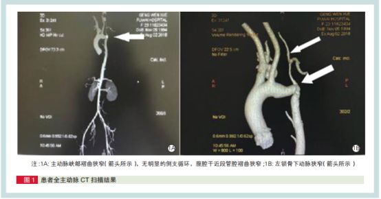 阜外医院误诊,阜外患者