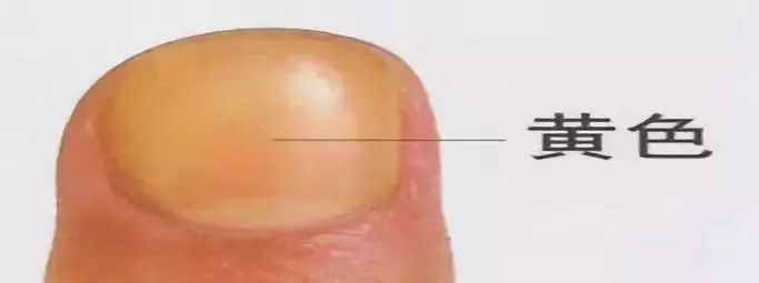 科普|指甲的状态反映了你身体的状况