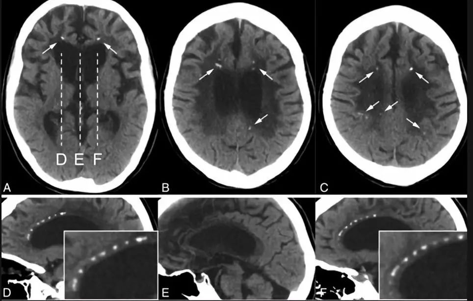 神经影像,神经影像解剖图