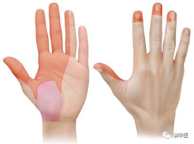 指尖发麻有针刺感看什么科室,左手拇指食指发麻针灸怎么治疗