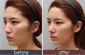 顶级神颜,韩国十大顶级神颜