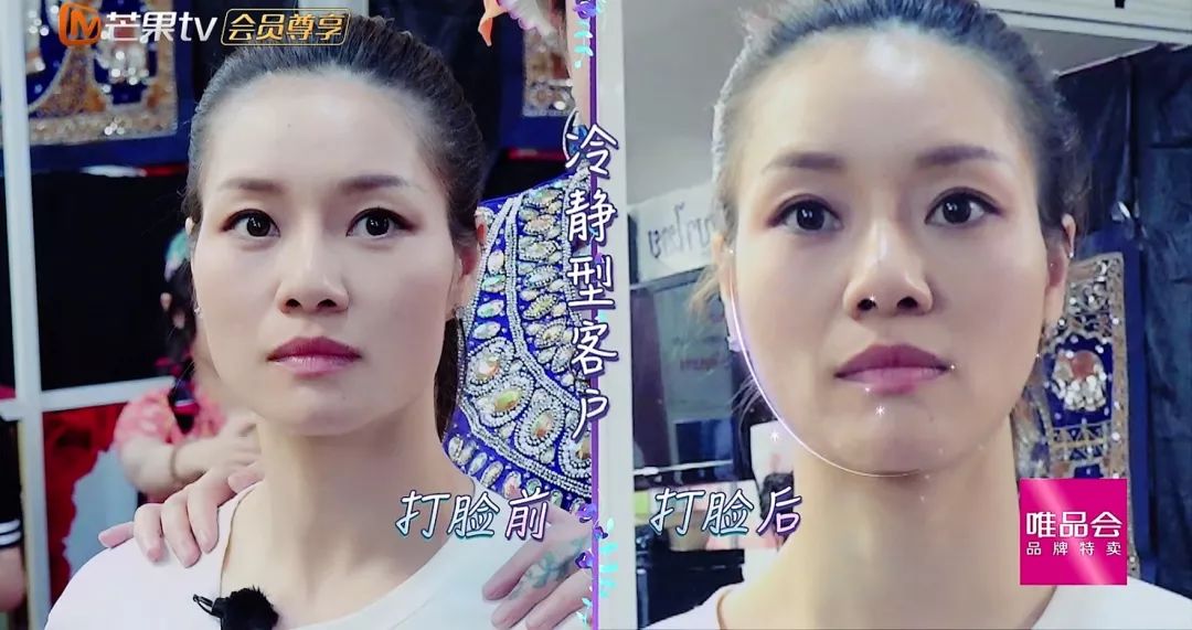 泰国打脸法瘦脸,泰国打脸术真的能瘦脸