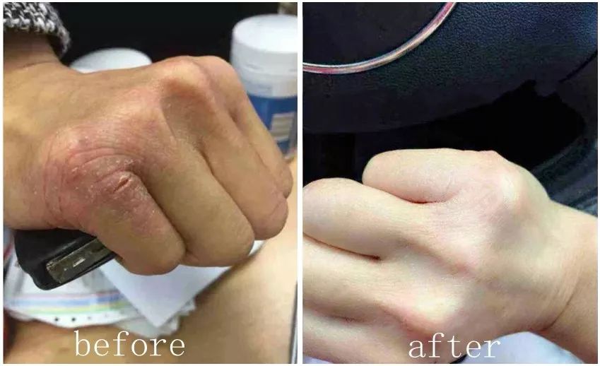 呵护手足|戴手套=精油SPA？还不耽误玩手机？30分钟急救手膜足膜，死皮老茧全消失，让你从头嫩到脚